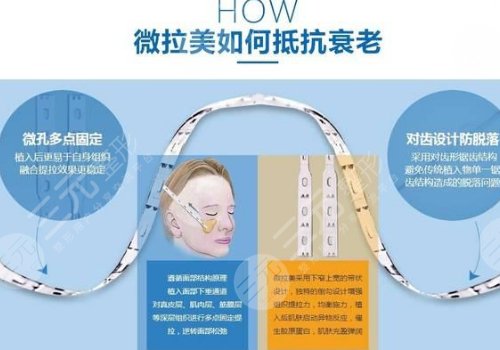 微拉美提升能保持幾年