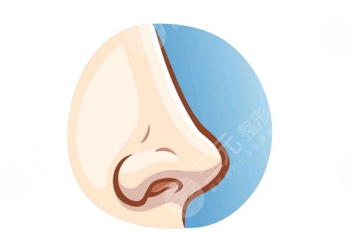 珠江醫(yī)院王晉煌做鼻子怎么樣