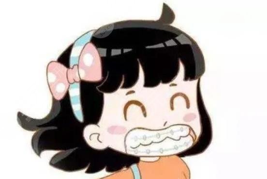 全瓷