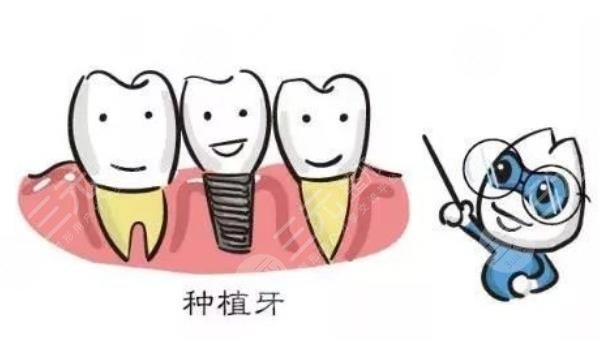 北京大學(xué)第三醫(yī)院種植牙案例