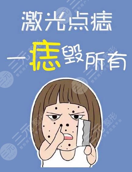 激光去痣