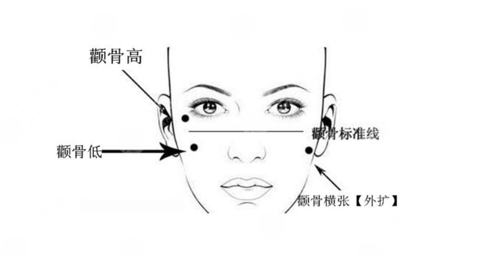 上海時光做顴骨多少錢