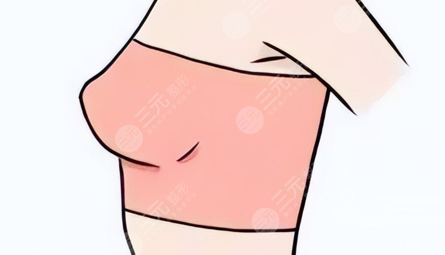 做了假體隆胸會(huì)不會(huì)癌變？乳腺專家跟蹤調(diào)查后總結(jié)~