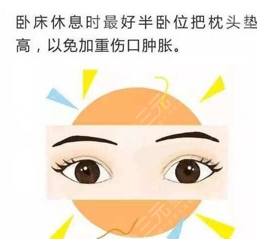 北京空軍總醫(yī)院整形外科雙眼皮案例