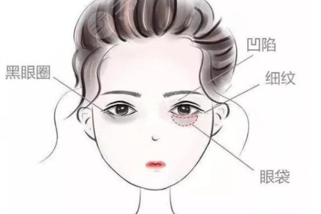 填眼窩