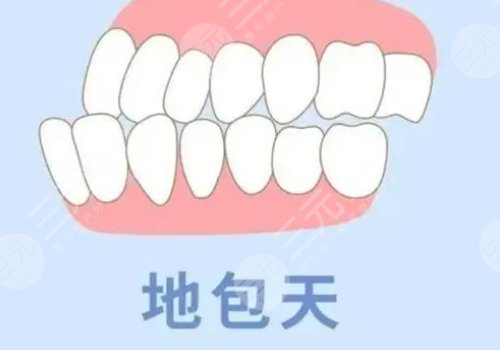 成人地包天手術(shù)整形費用多少