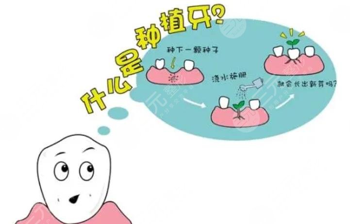 上海種植一顆牙齒大概多少錢(qián)