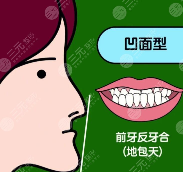 成人地包天手術(shù)整形費用多少錢？2023年市場均價1-3萬不等~