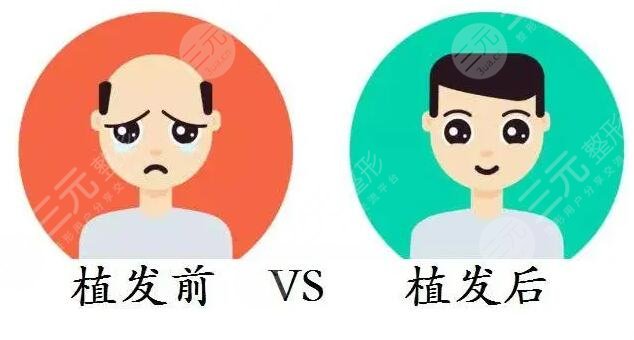 北京空軍總醫(yī)院植發(fā)案例分享