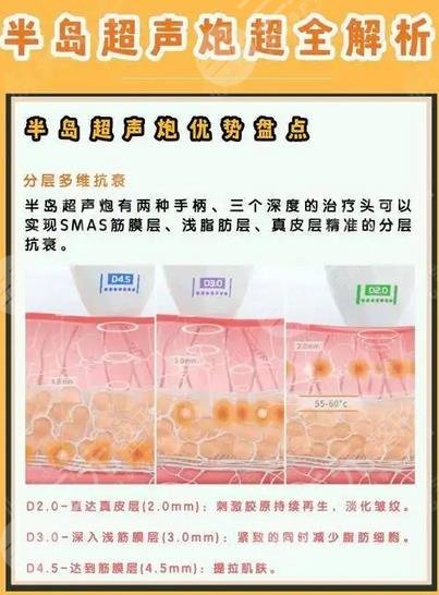 半島黃金超聲炮和超聲炮的區(qū)別有哪些？