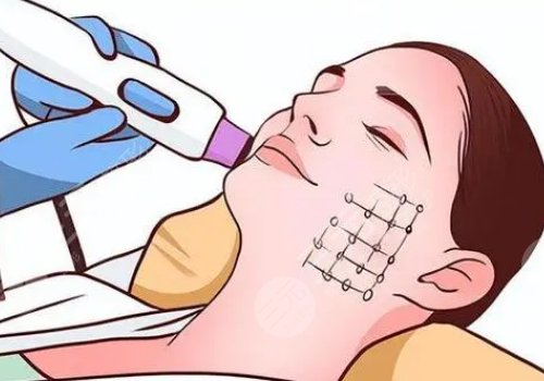 熱瑪吉是不是能量越高效果越好？