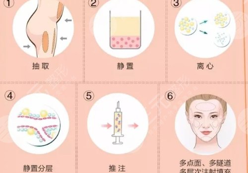 長(zhǎng)沙星雅醫(yī)療美容醫(yī)院怎么樣