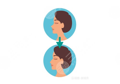 輪廓填充需要打**不