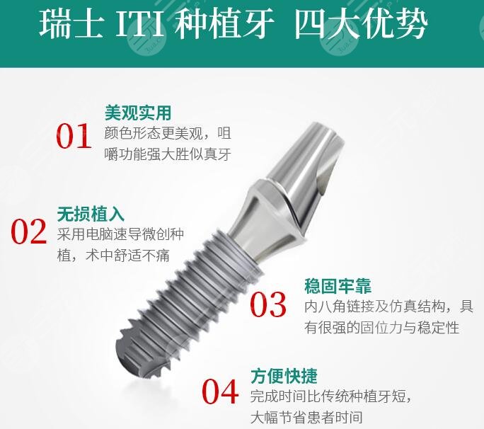 瑞士ITI種植牙品牌