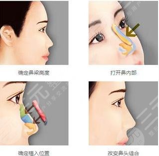 上海九院整形科坐診醫(yī)生信息