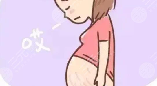 妊娠紋