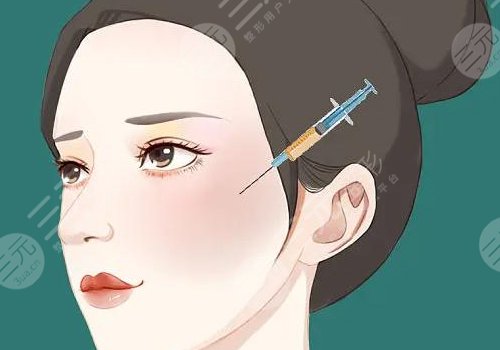 面部局部填充的作用