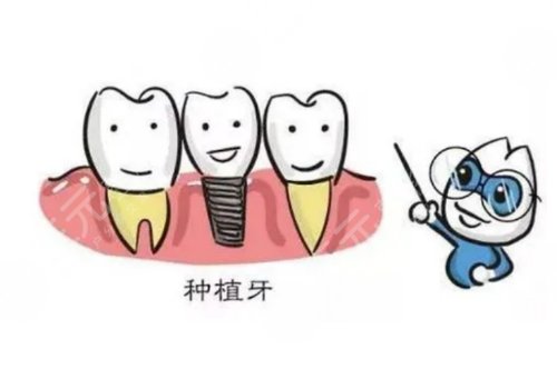 上海美奧口腔醫(yī)院種植牙怎么樣