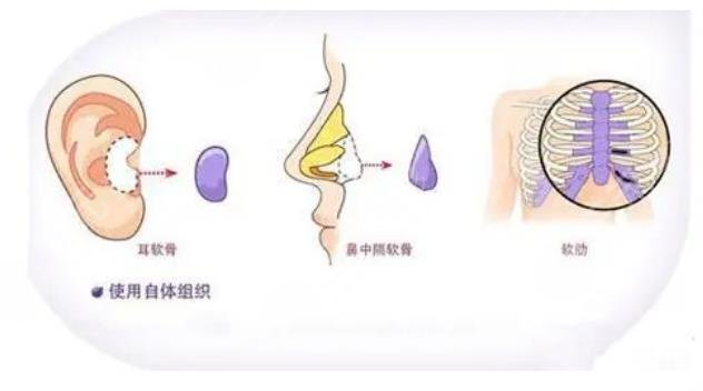 深圳陽光醫(yī)療美容醫(yī)院擅長科普知識(shí)