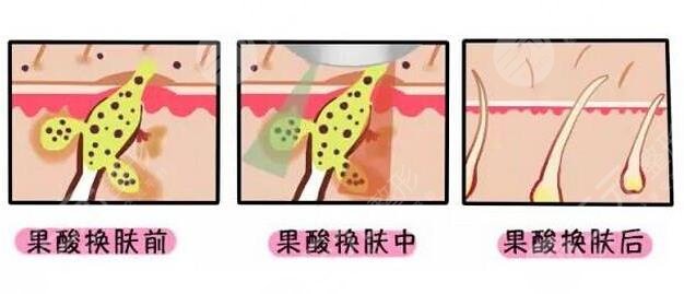 <p style="text-align: center;"> <span style="color:#ff0000;"><strong>【想變美嗎?預(yù)約醫(yī)生 獲取優(yōu)惠 點(diǎn)擊 →咨詢←】</strong></span></p>