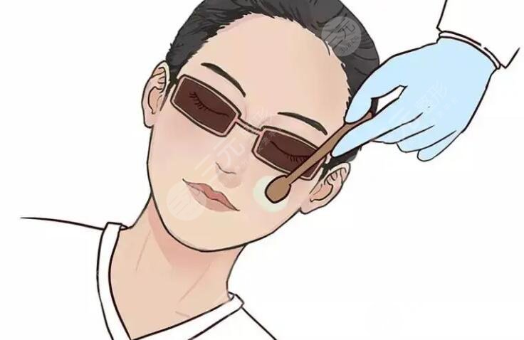 光子嫩膚