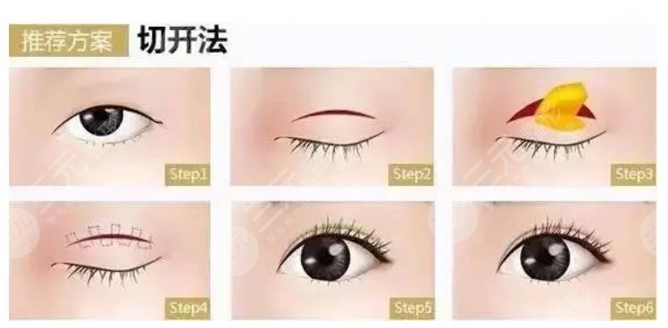 上海長(zhǎng)征醫(yī)院整形美容科特色項(xiàng)目