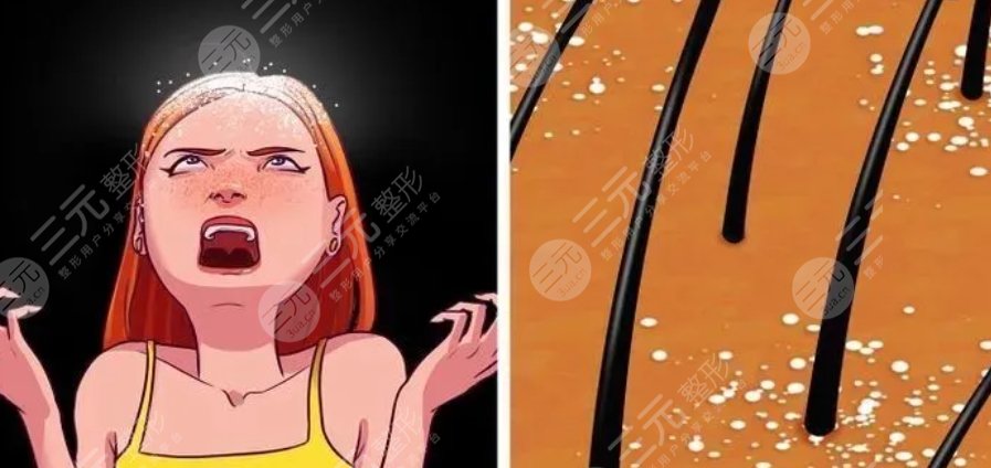 頭皮水光