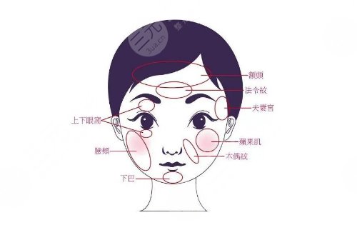 面部填充一般多少錢