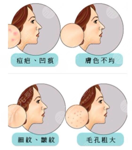 皮膚管理
