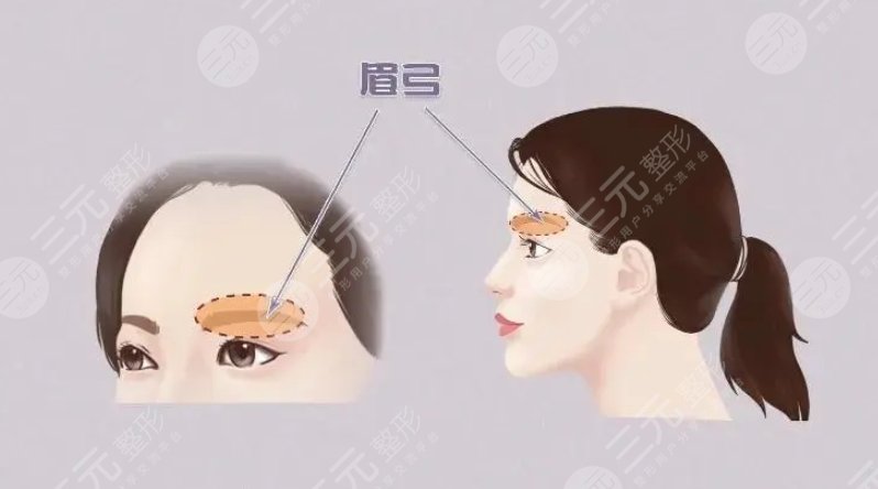 眉弓