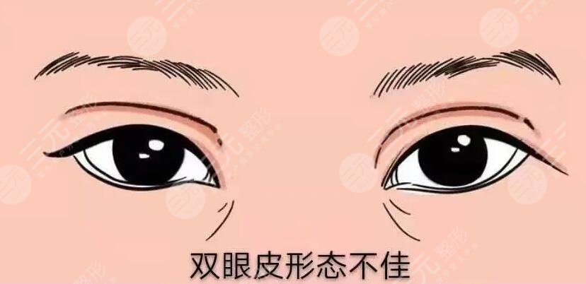 杜園園做眼修復(fù)手術(shù)案例