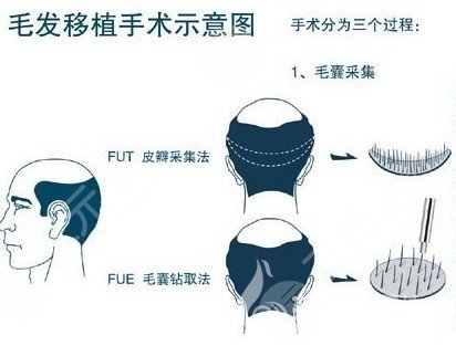 宋子廣醫(yī)生怎么樣?