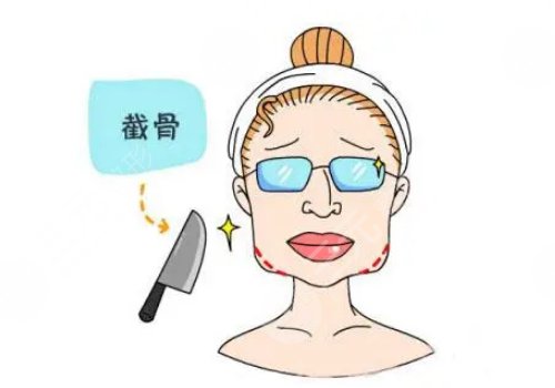 上海伊萊美削骨怎么樣