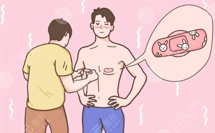 男生脂肪胸