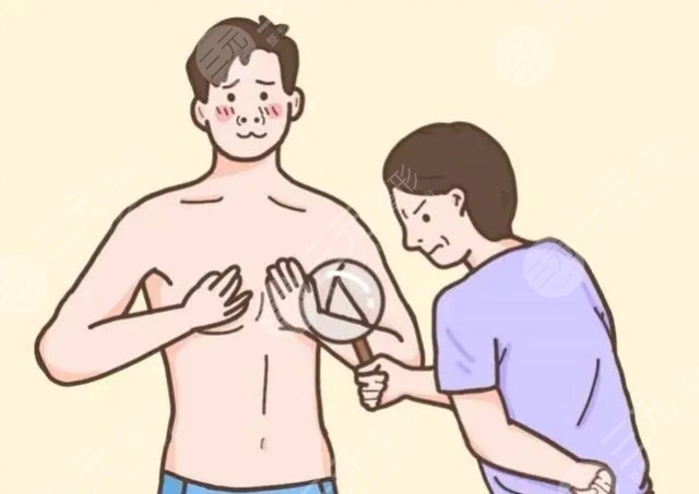 男生脂肪胸