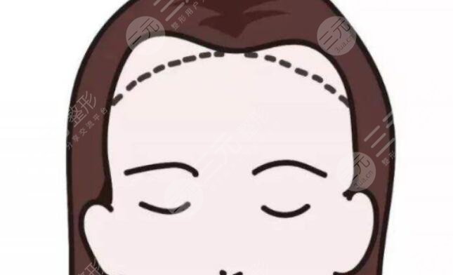 發(fā)際線