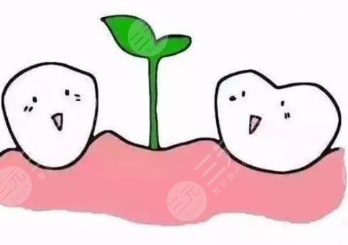 牙齒種植