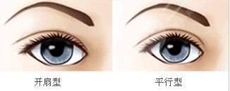 汪臘一醫(yī)生雙眼皮案例參考