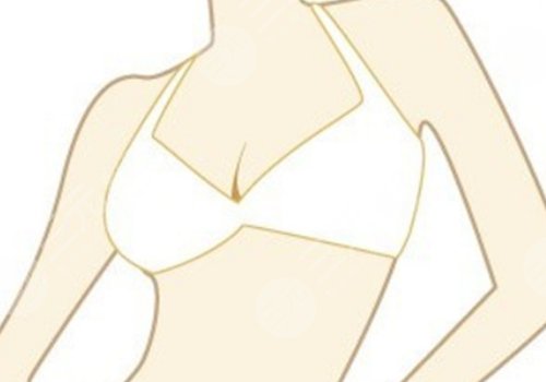 八大處辛敏強乳房下垂手術