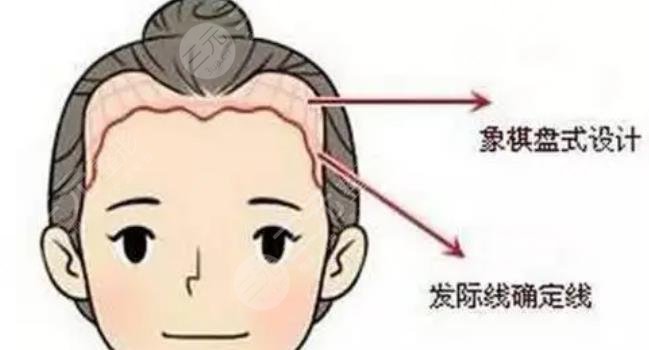 發(fā)際線