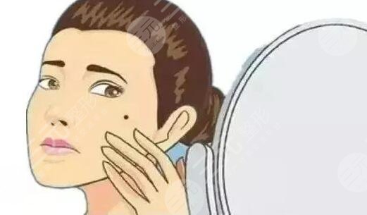 祛痣