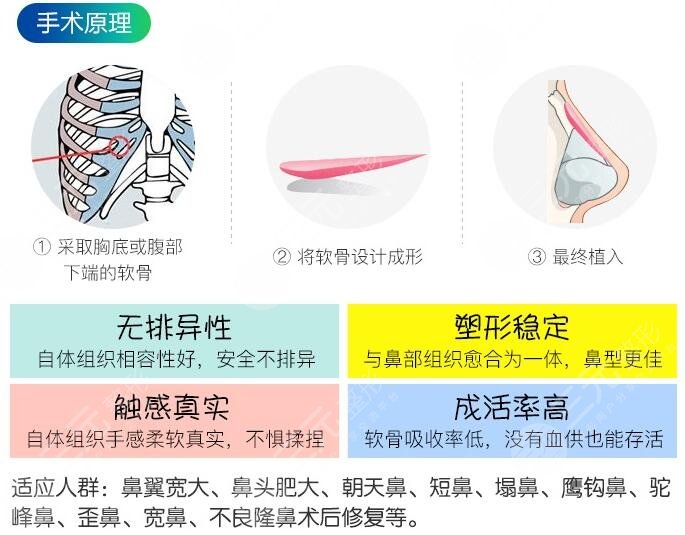 隆鼻