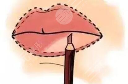 紋唇