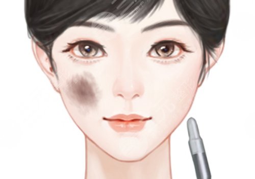 成都美容整形醫(yī)院疤痕胎記科正規(guī)嗎