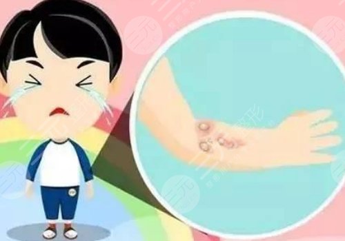 成都美容整形醫(yī)院疤痕胎記科正規(guī)嗎