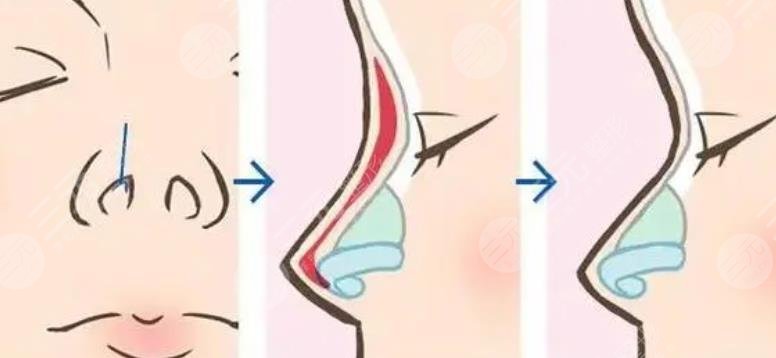 福州愛美爾醫(yī)療美容門診部特色項目
