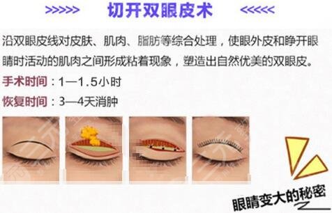 付敏醫(yī)生怎么樣？成都人氣整形醫(yī)生，簡介、雙眼皮案例點評！