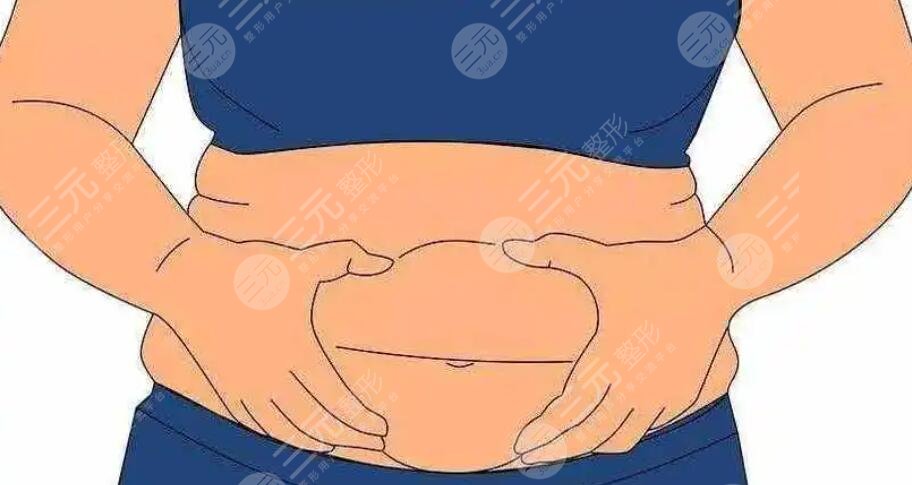吸脂