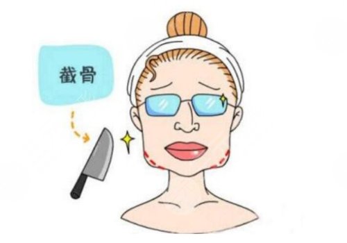 下頜骨削骨手術多少錢
