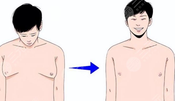 男生胸部肥肉怎么減